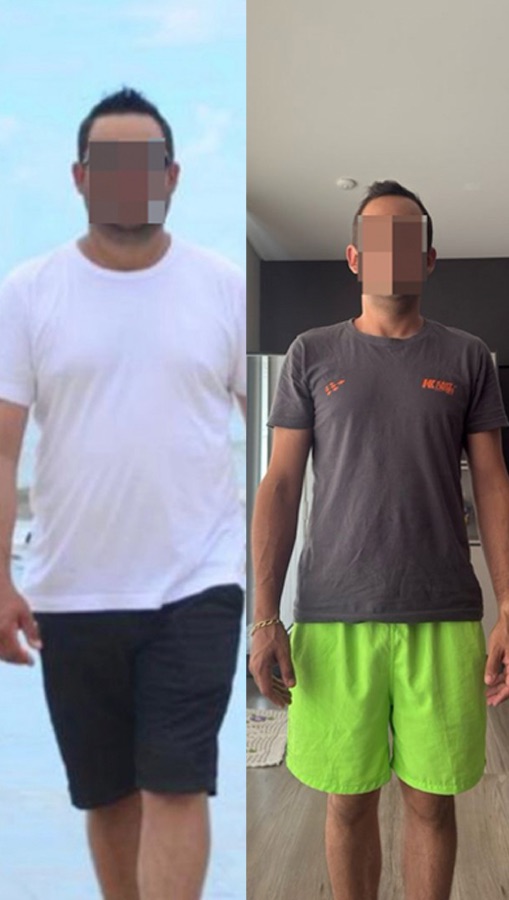 Paciente do Núcleo Neres, antes e depois do acompanhamento