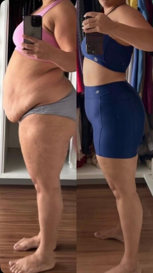 Paciente do Núcleo Neres, antes e depois do acompanhamento