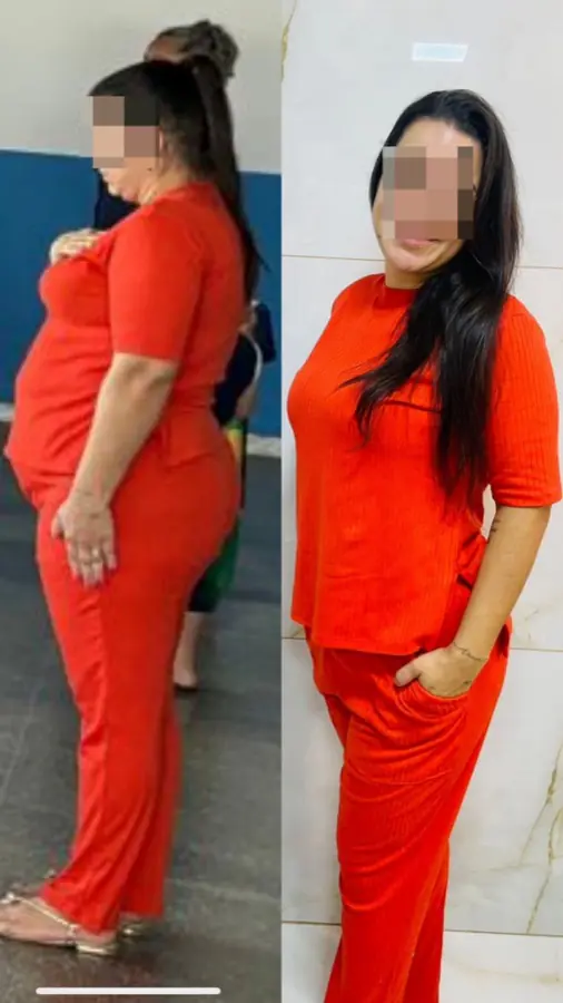 Paciente do Núcleo Neres, antes e depois do acompanhamento